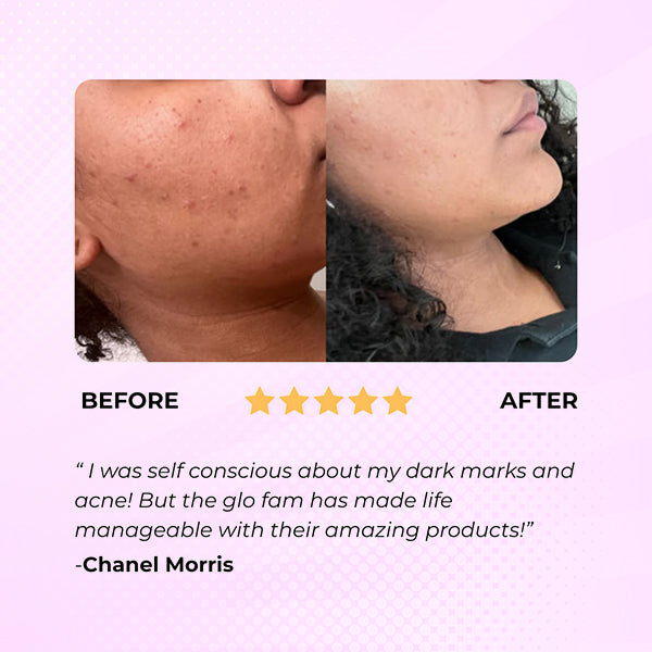 Glowmelanin™ Turmeric Soap