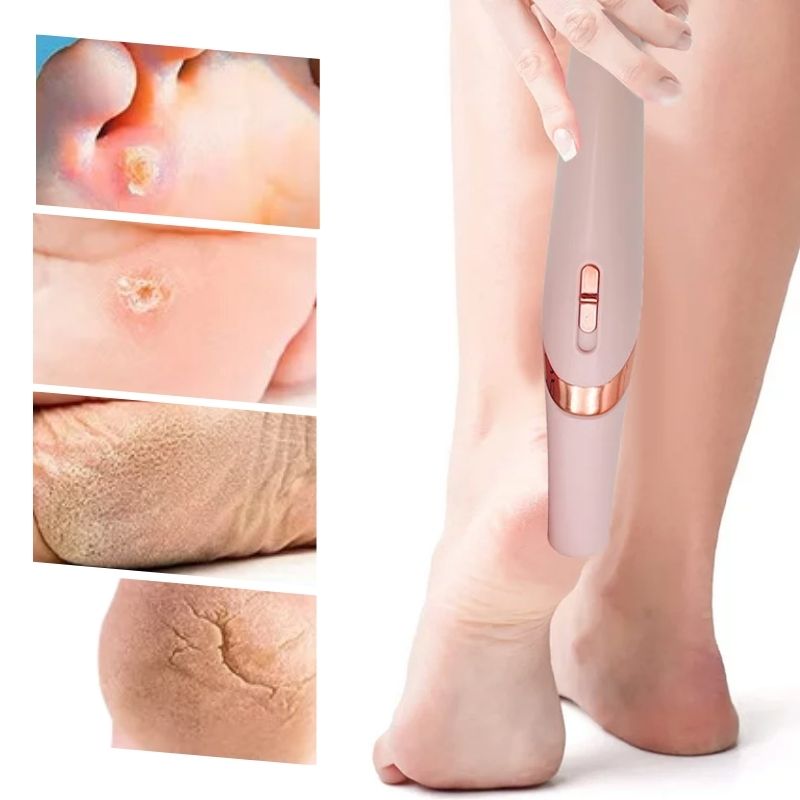 Glowsubi™ Natural Pedicure File