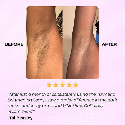 Glowmelanin™ Turmeric Soap